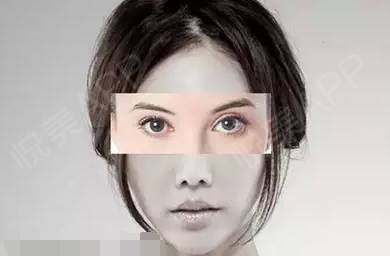 你是什么样的脸型,适合什么类型的双眼皮?